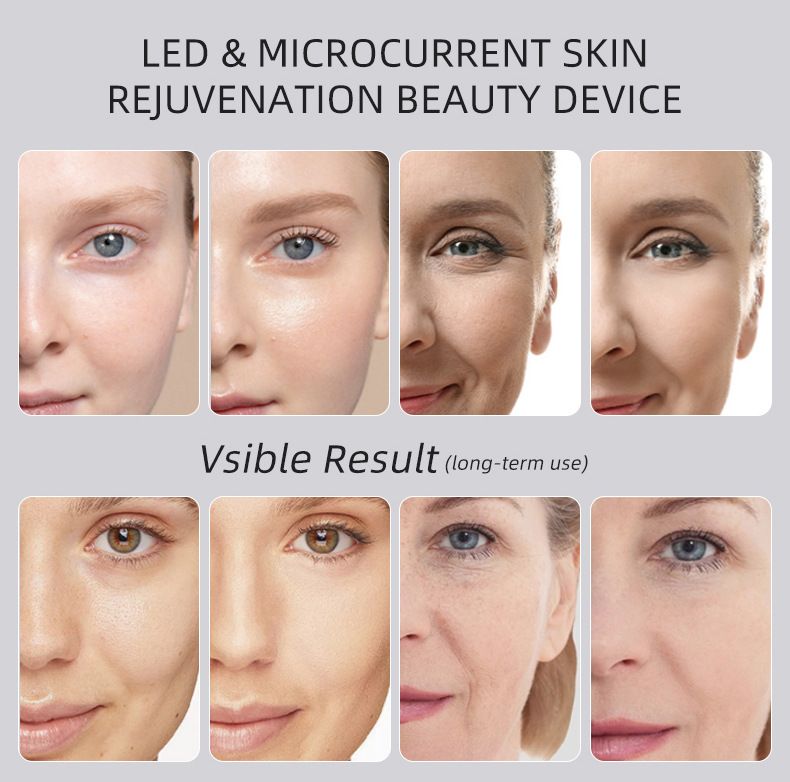 LED Facial Beauty Device – Pink